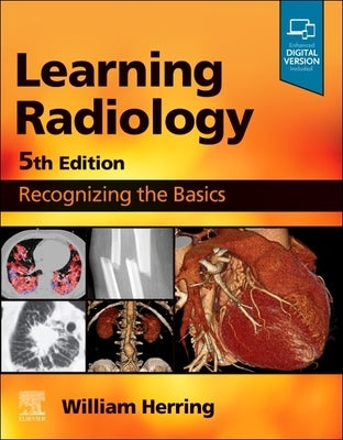 Paperback book "Learning Radiology: Recognizing the Basics" by Elsevier, featuring a clear cover design and spine.